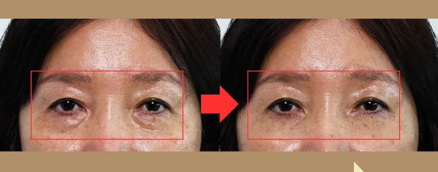 Nine less- Ever-Youth dual effect eye cream 20ml